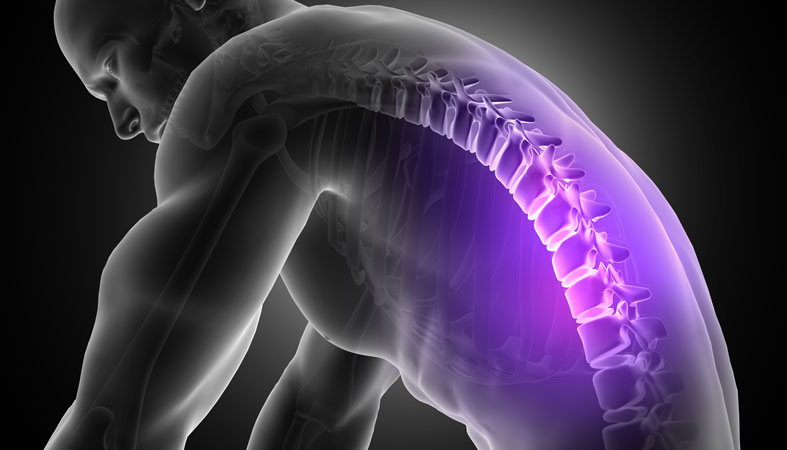 man with scoliosis pain
