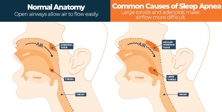 Normal vs Abnormal Respiratory System Anatomy Normal vs Abnormal Respiratory System Anatomy