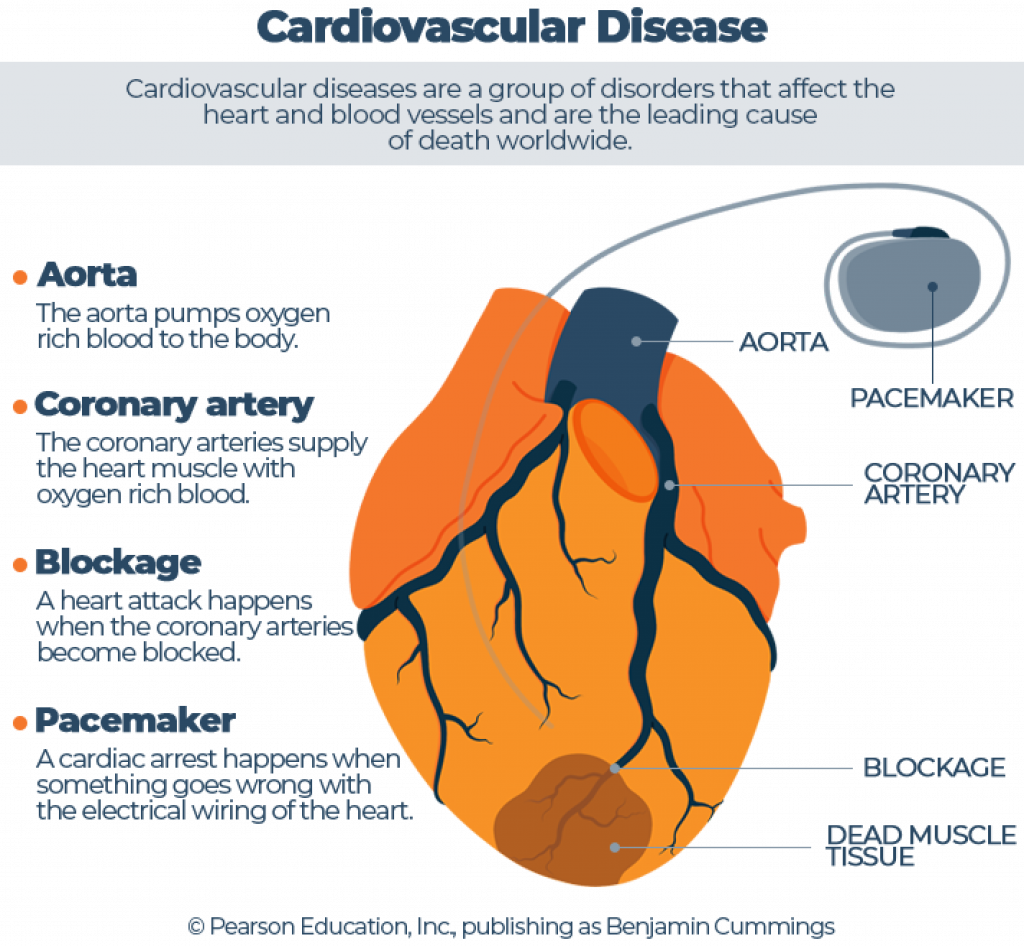 Illustrated Cardiovascular Disease