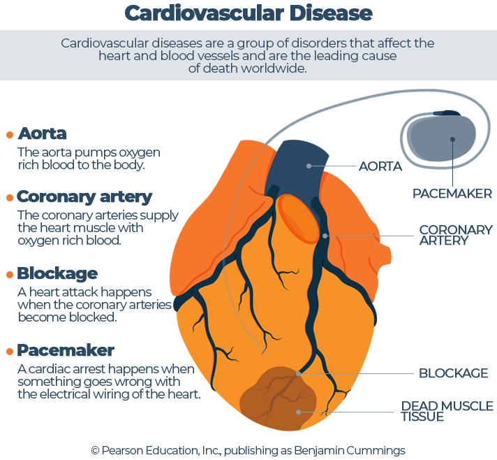 Illustrated Cardiovascular Disease