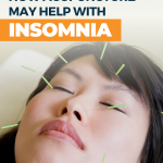 Acupuncture for Sleep