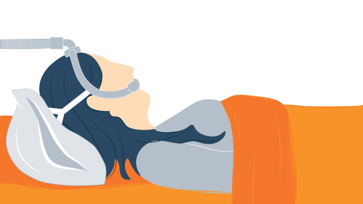 woman wearing CPAP mask with elbow hoses woman wearing CPAP mask with elbow hoses