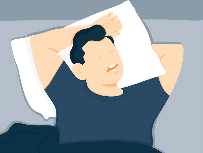 Illustration of a Man Sleeping with Mouthpieces on For Sleep Apnea Illustration of a Man Sleeping with Mouthpieces on For Sleep Apnea