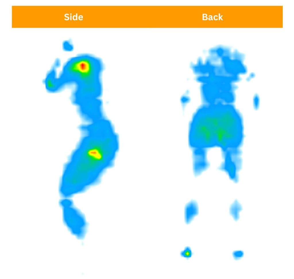 Our testers testing pressure relief feature of the Helix Plus through pressure maps.